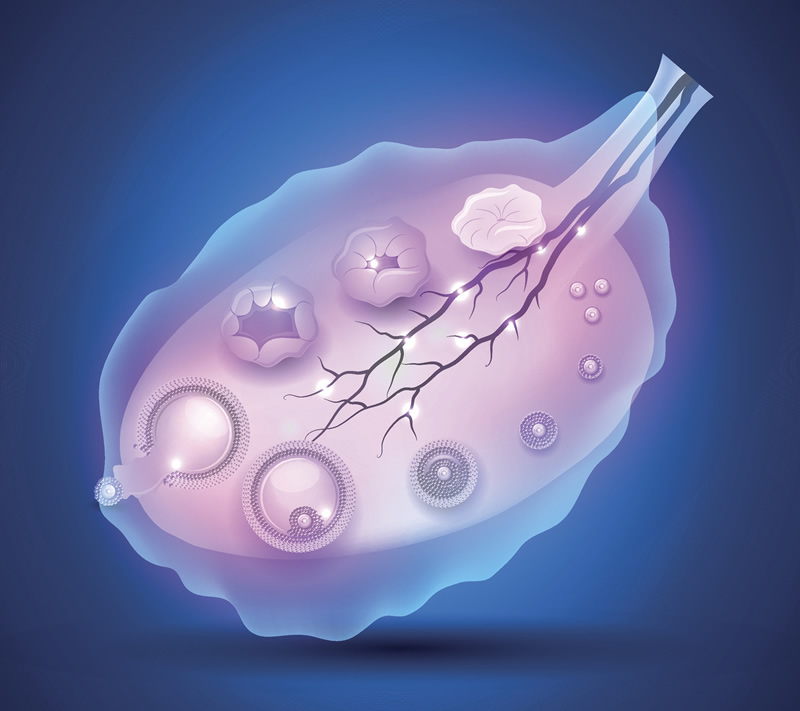 2026年子宫囊性腺肌症做试管婴儿三代收费价目表一览